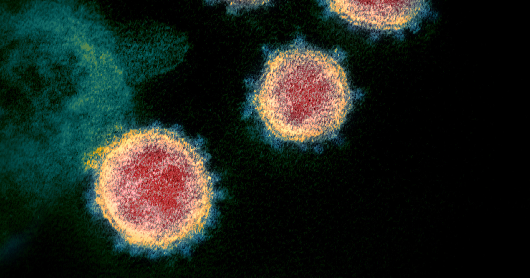 Electron microscope image of SARS-CoV-2 virus particles. Virus particles are shown emerging from the surface of cells cultured in the lab. Image captured and colourized at NIAID’s Rocky Mountain Laboratories in Hamilton, Montana. Photo by: NIAID. Creative Commons CC BY 2.0 DEED Attribution 2.0 Generic license: https://creativecommons.org/licenses/by/2.0/.