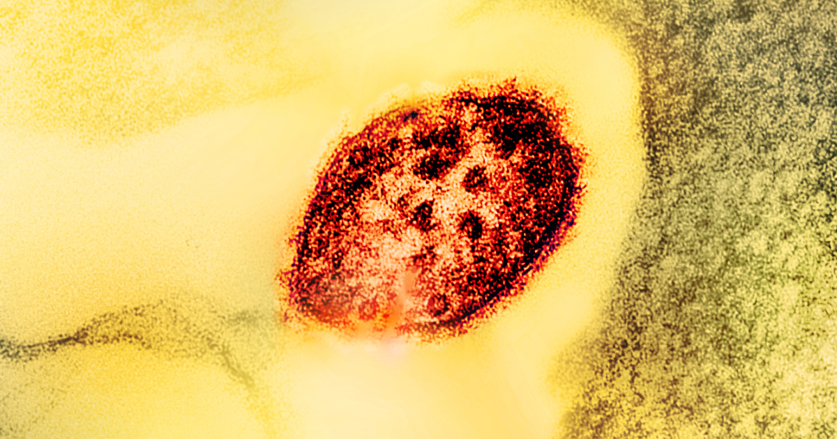 Colourized transmission electron micrograph of a measles virus particle (red). Photo: microscopy by CDC; layout, colorization and visual effects by NIAID. Licensed under Creative Commons CC BY 2.0 DEED Attribution 2.0 Generic license. https://creativecommons.org/licenses/by/2.0/