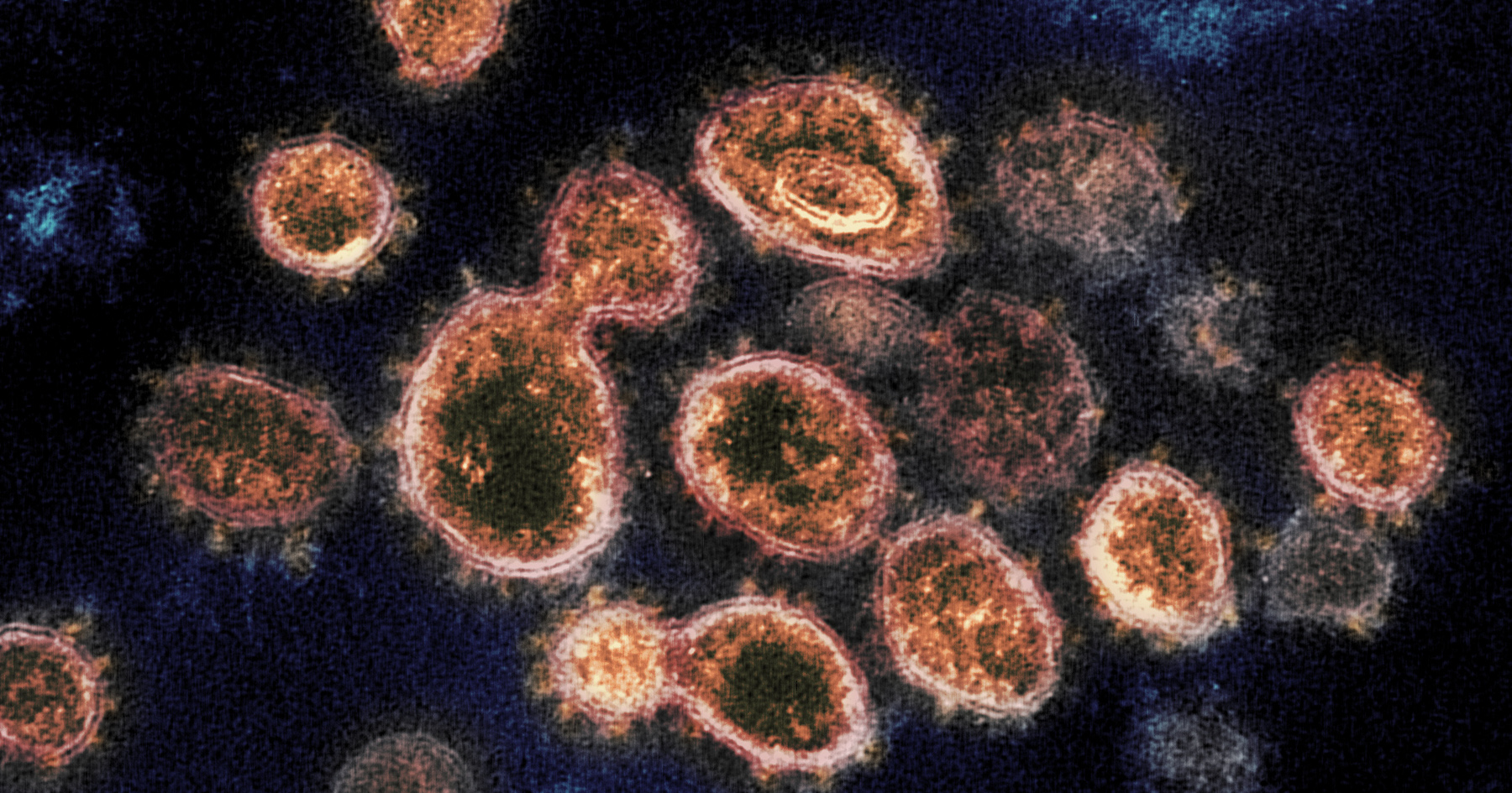 Electron microscope image of SARS-CoV-2 virus particles. Virus particles are shown emerging from the surface of cells cultured in the lab. Image captured and colourized at NIAID’s Rocky Mountain Laboratories in Hamilton, Montana. Photo by: NIAID. Creative Commons CC BY 2.0 DEED Attribution 2.0 Generic license: https://creativecommons.org/licenses/by/2.0/.