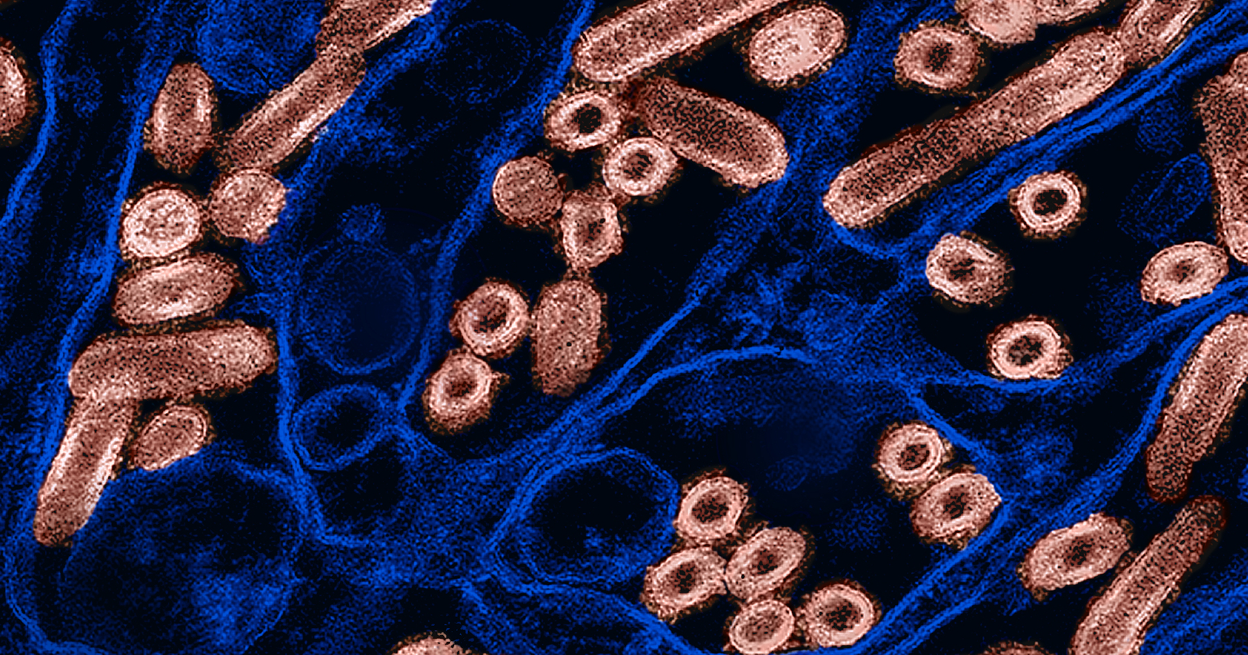 Colourized transmission electron micrograph of avian influenza virus particles. Photo: CDC and NIAID. Creative Commons CC BY 2.0 DEED Attribution 2.0 Generic license: https://creativecommons.org/licenses/by/2.0/.