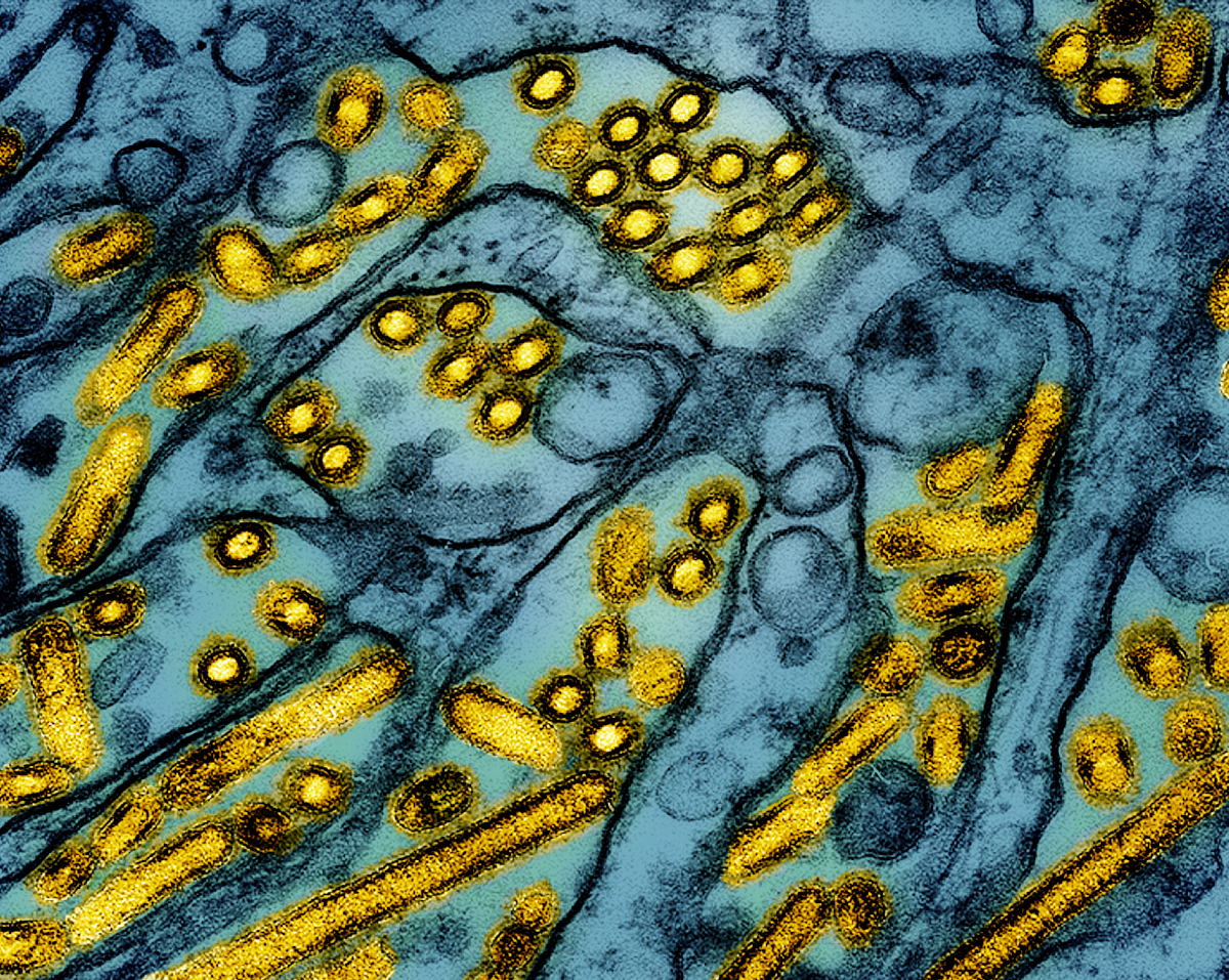 Colourized transmission electron micrograph of avian influenza A H5N1 virus particles (yellow), grown in canine kidney epithelial cells (blue). Photo: CDC and NIAID.