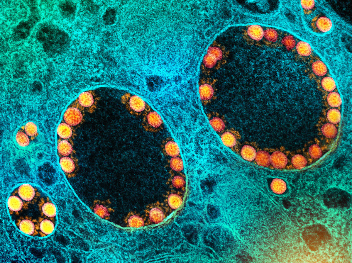 Image au microscope électronique de particules du virus SARS-CoV-2. Photo par : NIAID. Creative Commons CC BY 2.0 DEED Attribution 2.0 Licence générique : https://creativecommons.org/licenses/by/2.0/.