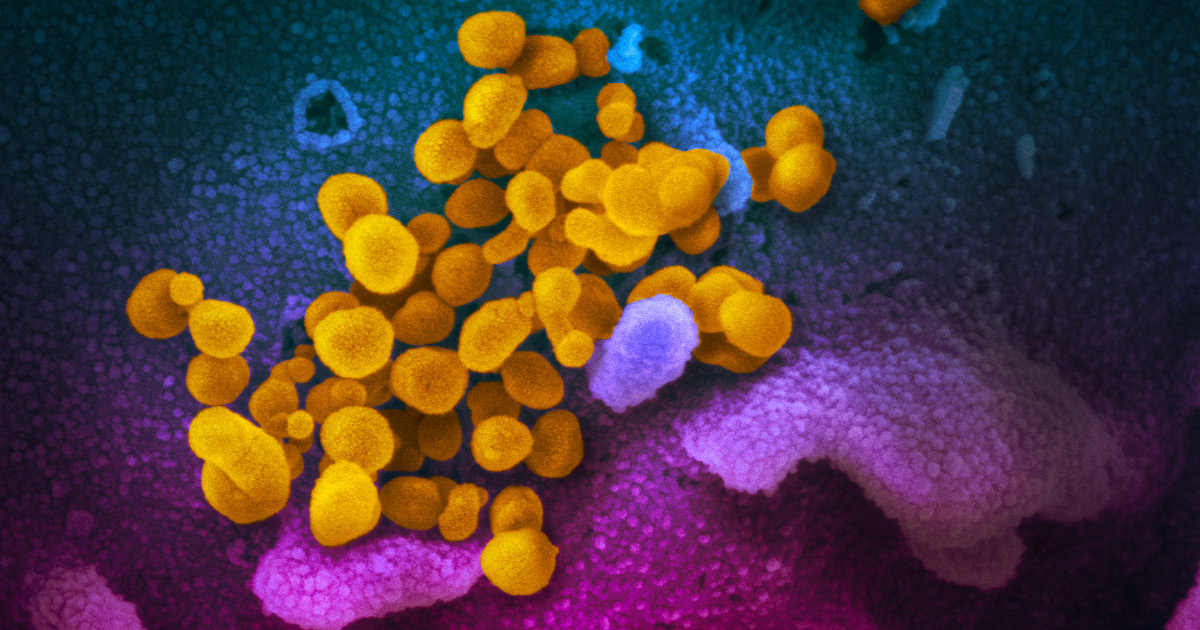 Cette image de microscope électronique à balayage montre des particules du virus SARS-CoV-2 (jaune), isolées d’un patient aux États-Unis, émergeant de la surface de cellules (bleu/rose) cultivées en laboratoire. Image capturée et colorisée aux Rocky Mountain Laboratories de NIAID à Hamilton, Montana. Source : NIAID.