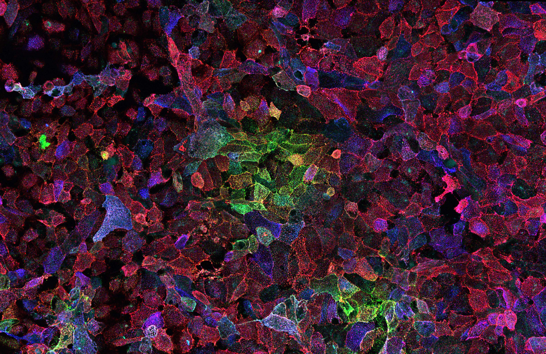 Photo de cellules infectées par le SRAS-CoV-2. Les rouges et les verts de l’image représentent des cellules infectées par le nouveau coronavirus qui cause la COVID-19. Photo : Alberto Domingo Lopez-Munoz, Laboratoire des maladies virales, NIAID/NIH.